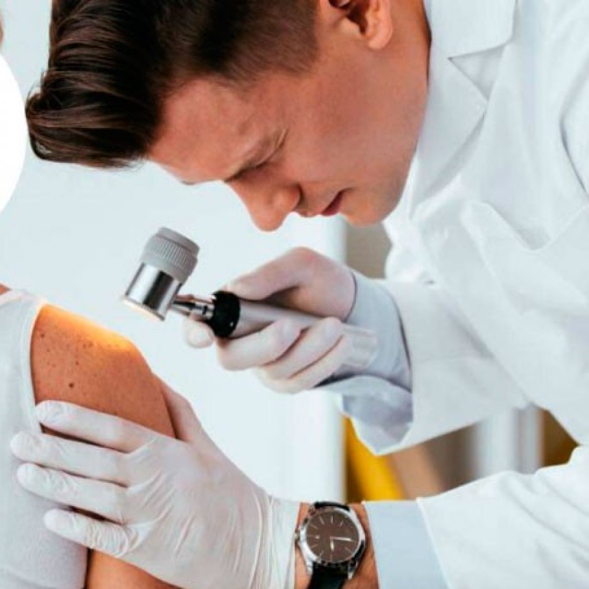 Recomendaciones para cuidar la piel en el verano