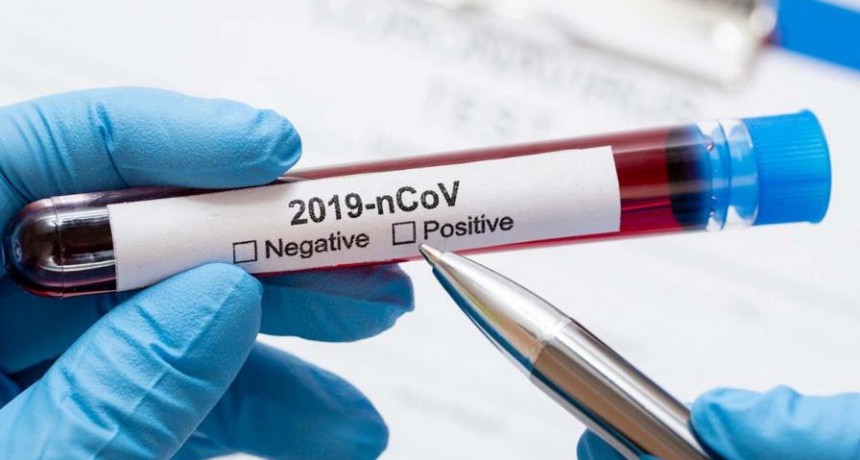 Confirmaron 4 nuevas muertes por coronavirus en la Argentina y el total de v&iacute;ctimas fatales asciende a 12