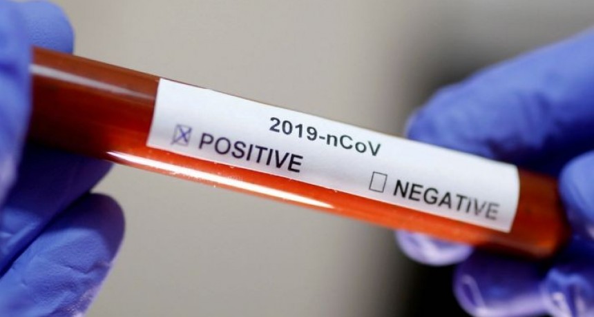 Coronavirus; Se confirmaron 79 nuevos casos y 4 fallecidos este martes