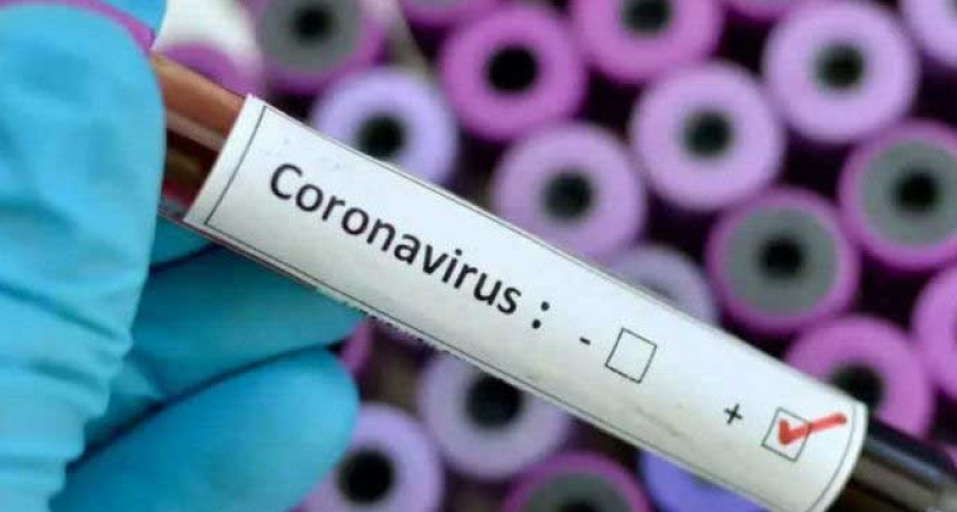 Este jueves fueron confirmados 132 nuevos casos de COVID-19 y se registraron 4 nuevas muertes