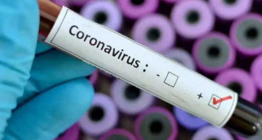 Fueron confirmados 98 nuevos casos de COVID-19;  suman 1.451 positivos en el pa&iacute;s