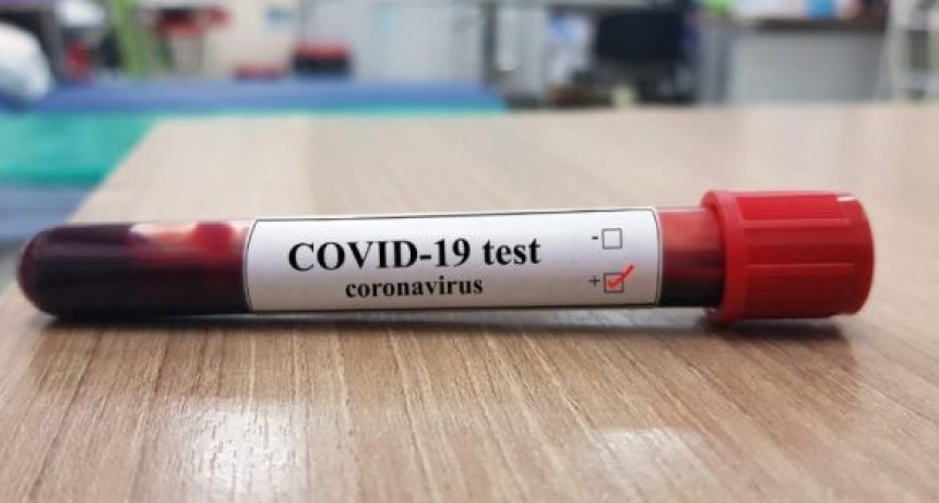 Coronavirus: confirman 87 nuevos casos y suman 1.715 en todo el pa&iacute;s
