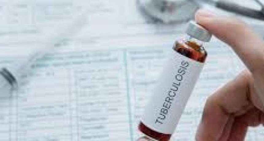 La vacuna BCG reduce la tasa de mortalidad por coronavirus, afirma un estudio