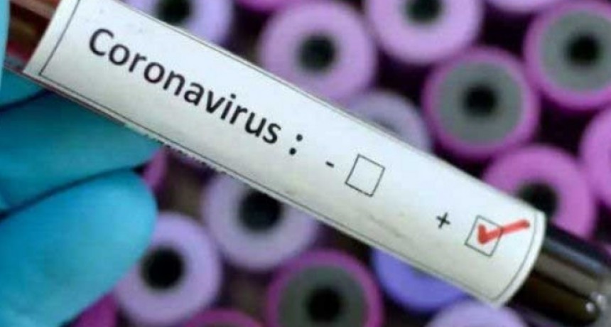 Lobos; Primer caso de COVID 19 Positivo