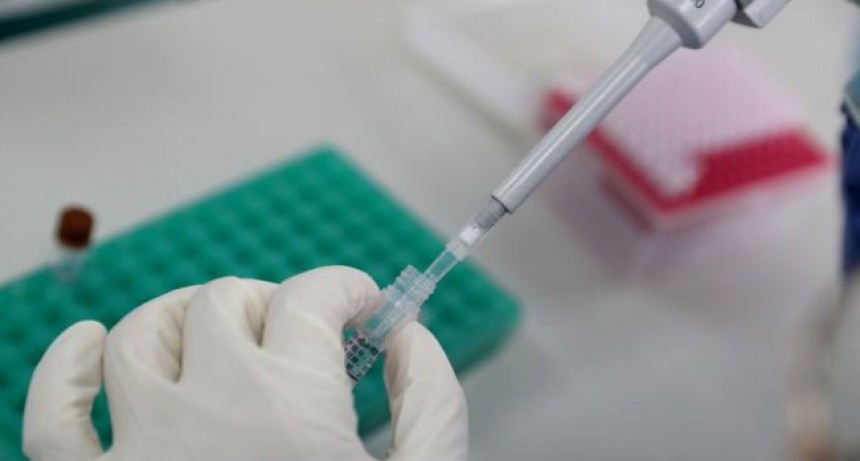 P&eacute;rdida del gusto y el olfato se agregan a la definici&oacute;n de caso sospechoso de Covid-19
