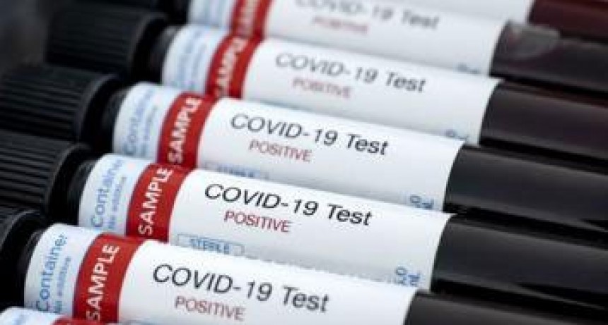 Fallecieron dos personas en Mendoza y La Rioja y son 124 las v&iacute;ctimas fatales del coronavirus