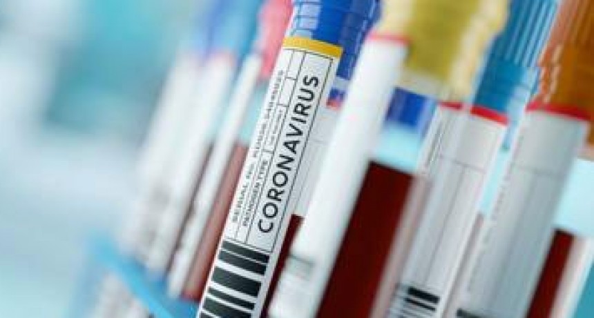 Hubo 88 nuevos casos positivos y siete muertes por coronavirus: las v&iacute;ctimas ya son 129