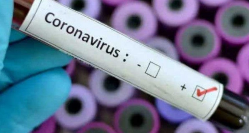 Covid-19 en el pa&iacute;s: se confirmaron 112 casos nuevos, hay 3.144 positivos y 151 muertos