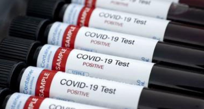 Covid-19 en el pa&iacute;s: hay 112 casos nuevos, 3.892 positivos en total y 192 muertos