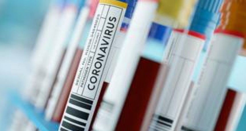 Suman 282 los fallecidos y 5.371 los infectados por coronavirus en Argentina