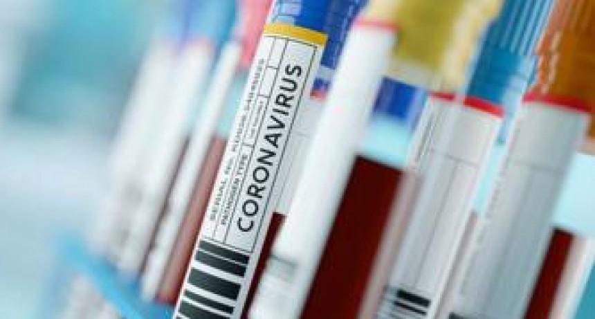 Coronavirus: suman 319 la cantidad de fallecidos y 6.563 los casos confirmados en el pa&iacute;s