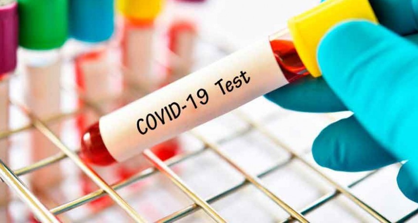 Suman 329 las v&iacute;ctimas fatales y 6.879 los contagiados de coronavirus en el pa&iacute;s