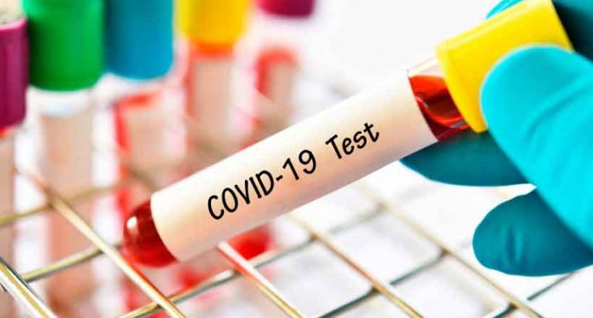 Coronavirus: suman 356 los muertos y 7.479 los casos positivos en el pa&iacute;s