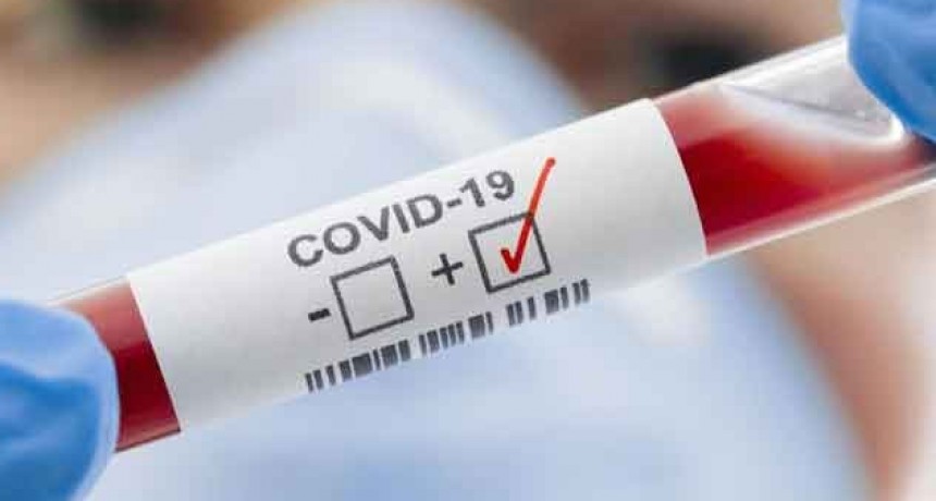 La cifra de v&iacute;ctimas fatales por coronavirus en el pa&iacute;s se elev&oacute; a 366 tras confirmarse otras tres muertes
