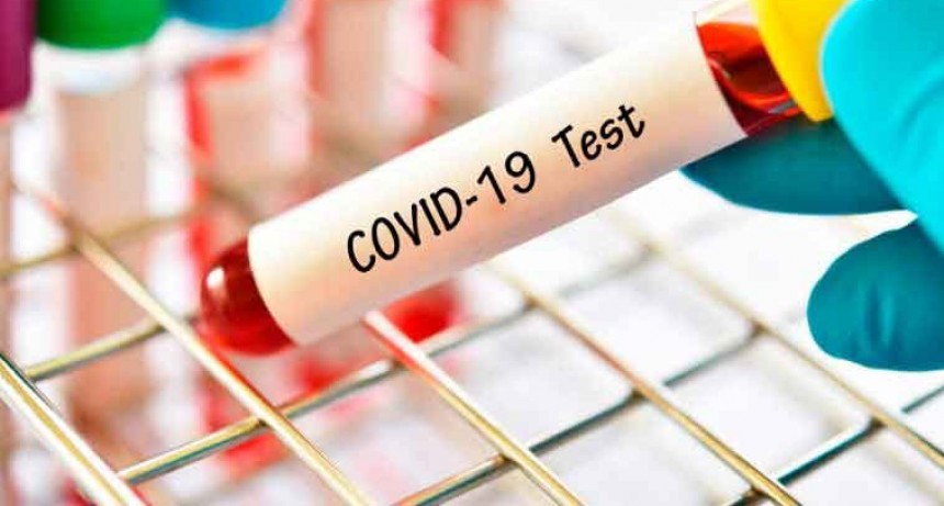 D&iacute;a r&eacute;cord: El jueves se confirmaron 648 casos de coronavirus y 13 muertes