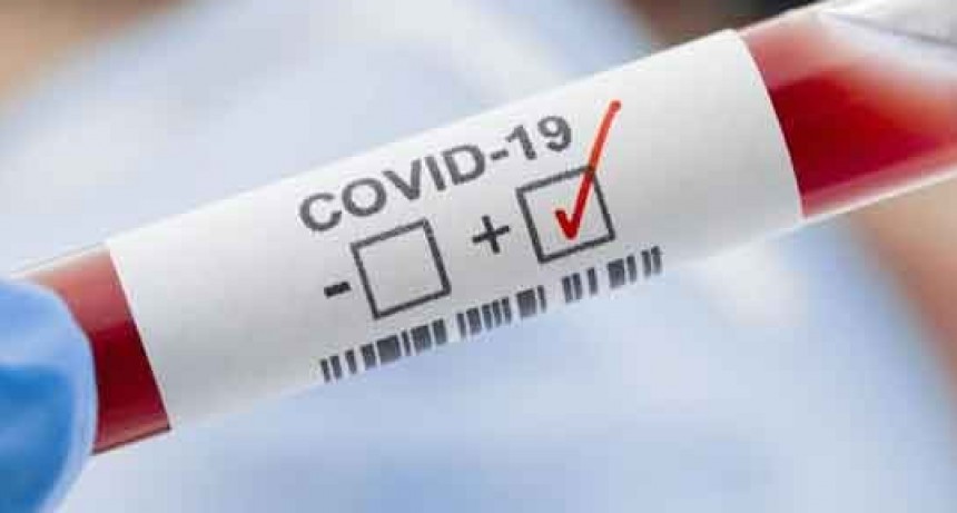 Ascienden a 452 los fallecidos y a 12.076 los positivos de coronavirus en Argentina