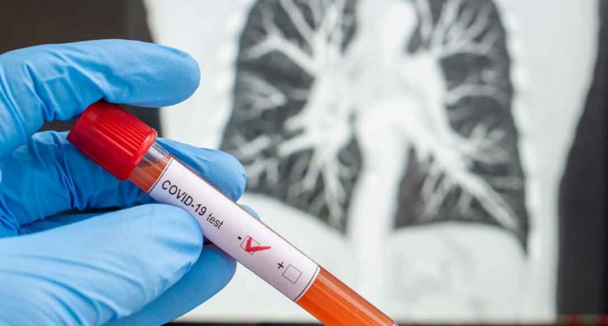Covid-19 en el pa&iacute;s: se confirmaron 706 nuevos casos y diez muertes