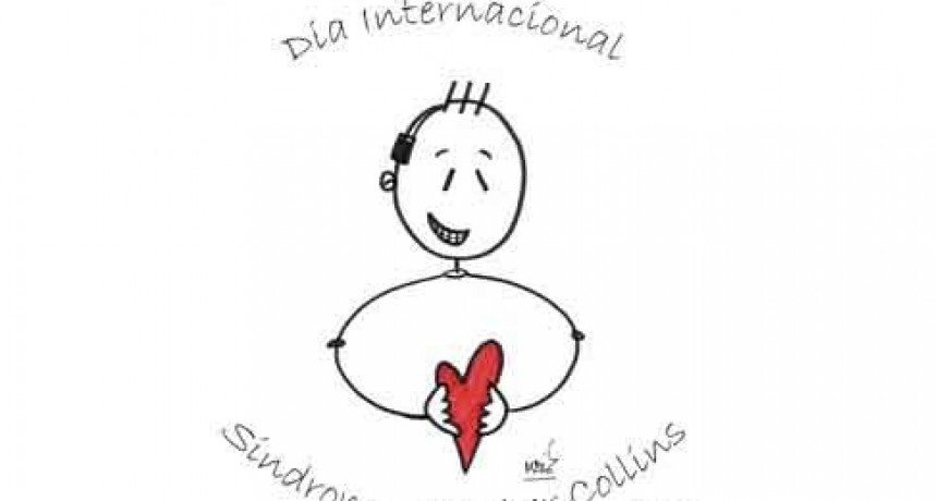28 de Mayo; D&iacute;a Internacional del S&iacute;ndrome de Treacher Collins