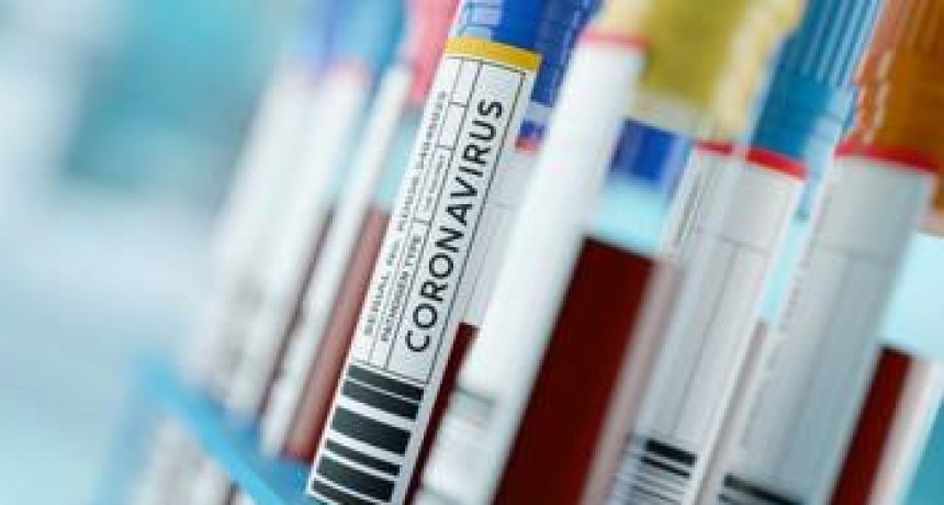 Suman 539 los fallecidos y 16.851 los infectados por coronavirus en Argentina