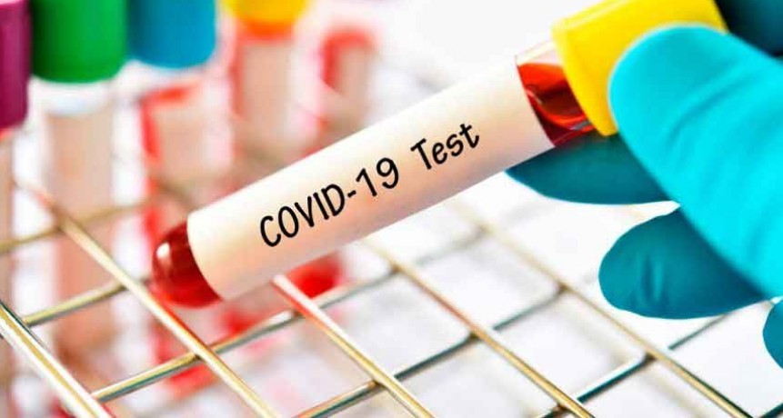 Reportan diez nuevos muertos por coronavirus y suman 642 los fallecidos en la Argentina