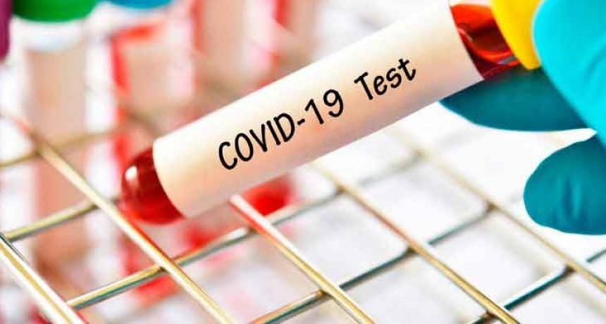 Suman 664 las v&iacute;ctimas fatales y a 22.794 los infectados de coronavirus en Argentina