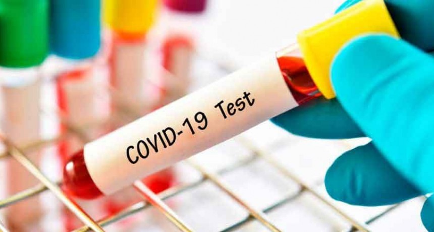 Informan siete nuevos fallecimientos y suman 772 los muertos por coronavirus en la Argentina