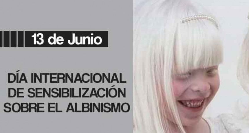 D&iacute;a Internacional de Sensibilizaci&oacute;n sobre el Albinismo