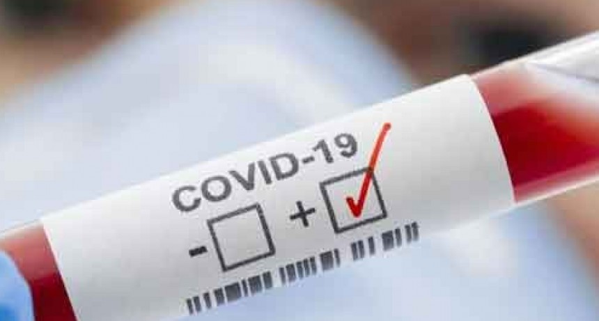 Coronavirus: son 1.393 los casos que se registraron en las últimas 24 horas