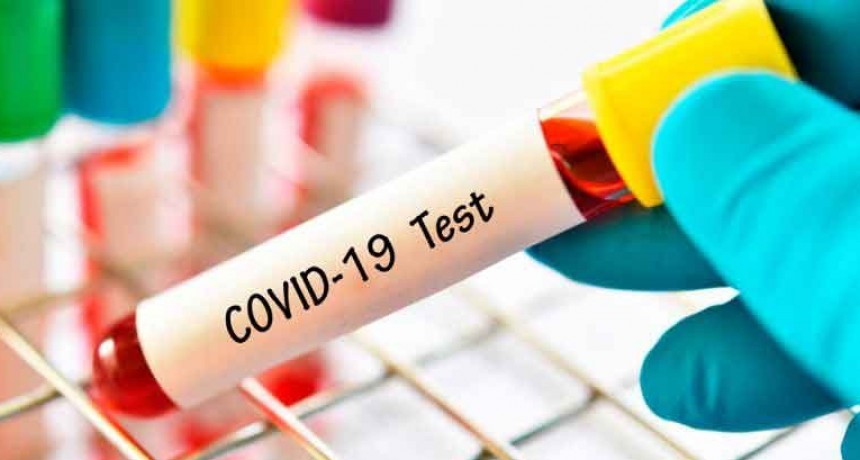 Ascienden a 1.078 los fallecidos y 47.216 los contagiados desde el inicio de la pandemia