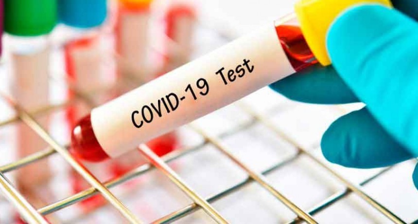 Coronavirus: informan 17 nuevas muertes dando un total de 1167 fallecidos desde marzo