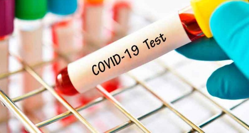 Coronavirus: ascienden a 1.307 los fallecidos y 64.530 los contagiados en el pa&iacute;s