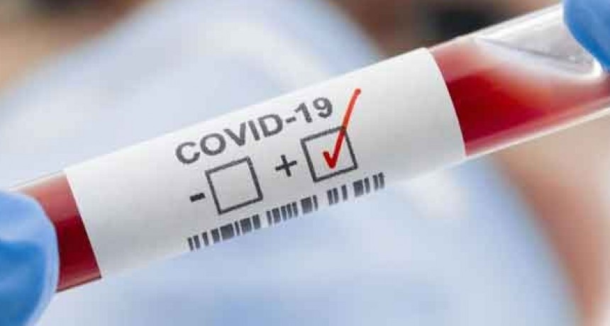 Informan 16 nuevos fallecimientos y suman 1.453 los muertos por coronavirus en la Argentina