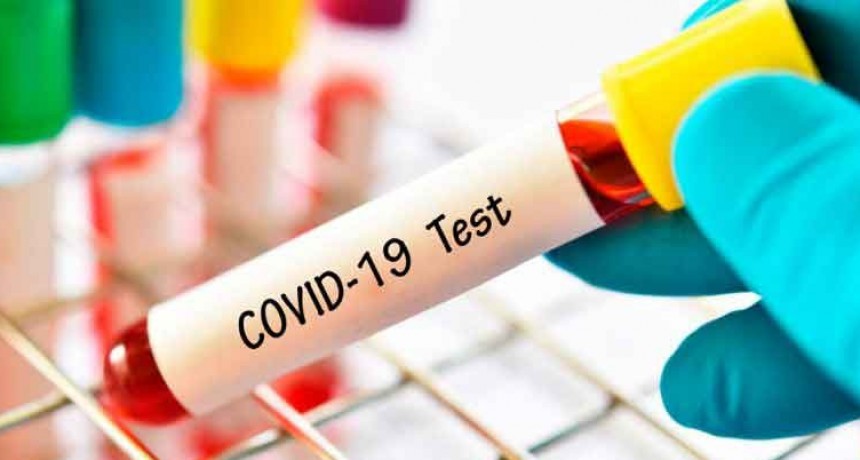 Coronavirus en la provincia; Registro de casos positivos en las &uacute;ltimas 24 horas