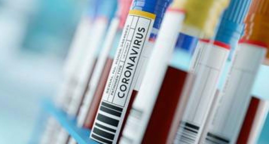 Informan 17 nuevos fallecimientos y suman 2.956 los muertos por coronavirus en el pa&iacute;s
