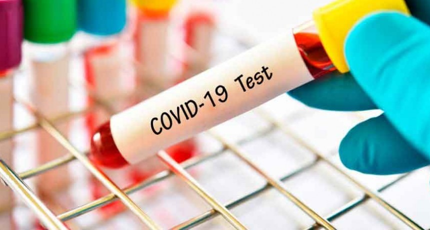 COVID 19; Informaci&oacute;n oficial sobre casos confirmados en la zona en las 24 horas