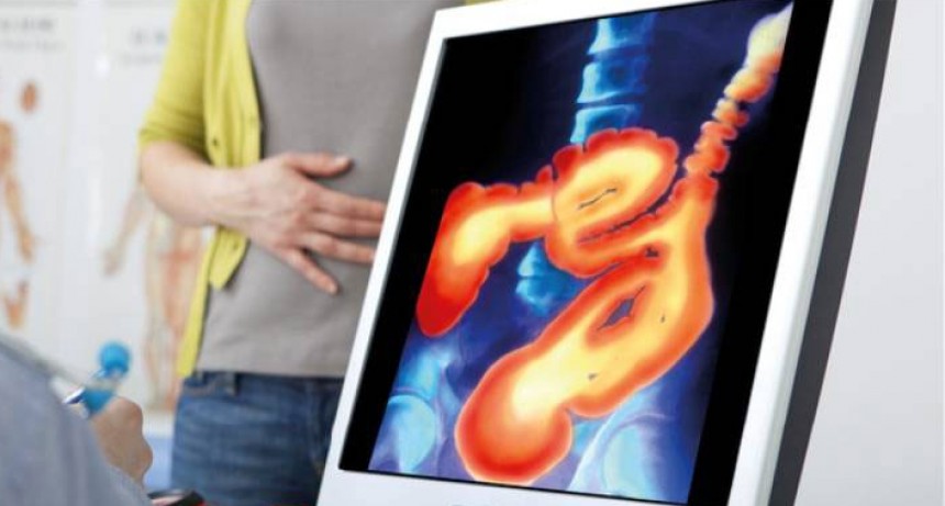 Contin&uacute;a la campa&ntilde;a de prevenci&oacute;n del c&aacute;ncer colorectal