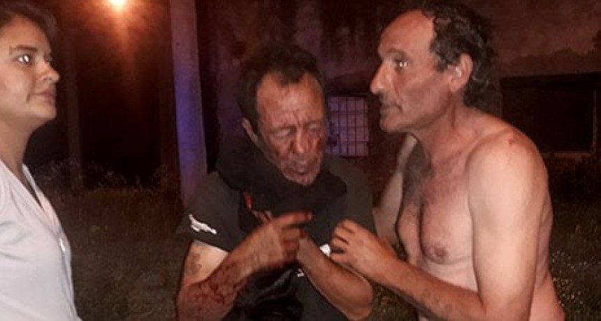 Noticia de InfoBis: Un herido de consideración dejó la explosión de una garrafa en una esquina del Barrio Las Flores